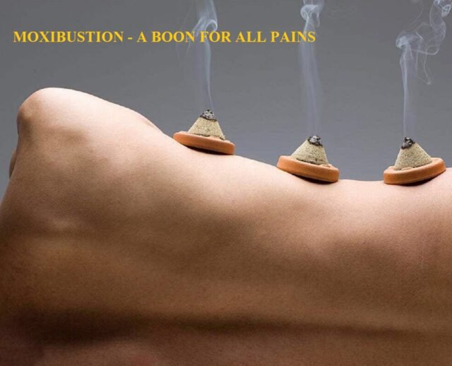 MOXIBUSTION - A BOON FOR ALL PAINS