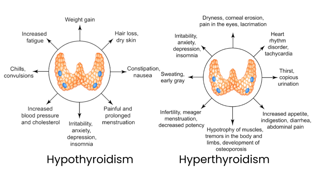 Thyroid types - Hypo and Hyper Thyroidism