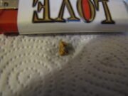 Glue Ear in Children: Symptoms, Treatment and Hearing Tests Earwax removed from an ear