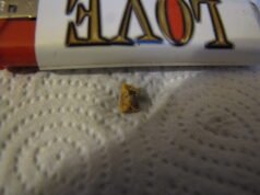Sudden Hearing Loss: Warning Signs and When to Get Urgent Care Earwax removed from an ear