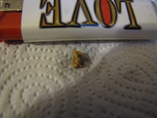 Earwax removed from an ear