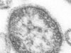 US Measles Cases 2026: Why the Count Is Higher Than All of 2025 Measles virus particles, CDC image (public domain via Wikimedia Commons)