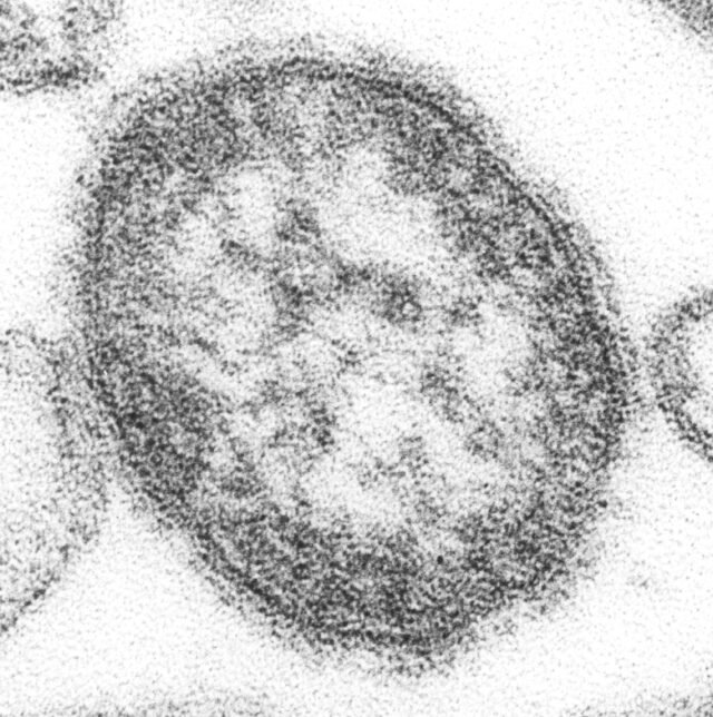 Measles virus particles, CDC image (public domain via Wikimedia Commons)
