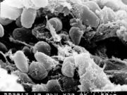 Siberia Plague Lab Death: What We Know and What Is Still Unclear Electron micrograph of Yersinia pestis, the bacterium that causes plague