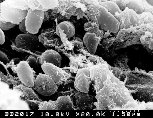 Electron micrograph of Yersinia pestis, the bacterium that causes plague